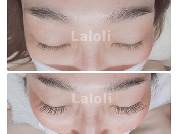 ラロリ(Laloli)/《フラットラッシュ》100本