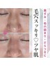 <毛穴の黒ずみ撃退!>全顔ハイドロ毛穴洗浄+ヘッド10分 11,000円