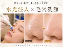 アイムエステ 横浜店(i'm este)の雰囲気（小顔/毛穴洗浄/毛穴/フェイシャル/シミケア/ニキビケア/横浜）