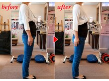 プーラビタ(PURAVITA)/姿勢/反り腰/腰痛　before after