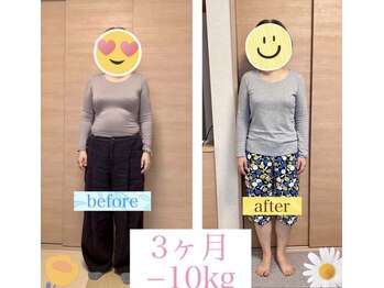 ミラクル ビー(ミラクル Bee)/お客様１