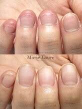 マリーロール 梅田店(Marie Laure)/自爪育成/深爪矯正/ネイルケア