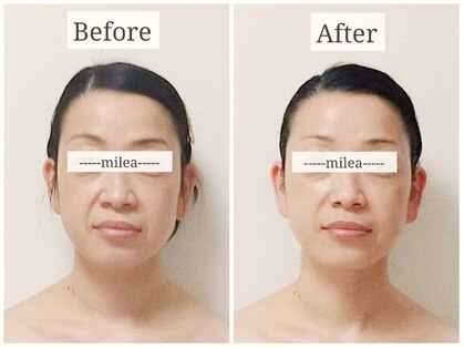 ミレア(Milea)の写真