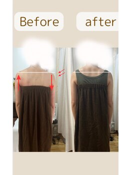 アイヲン(Aiwon)/【首コリ】【猫背】