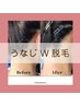【最短☆美肌うなじ脱毛】今すぐツルスベキレイ肌！U型・W型おこのみで◎
