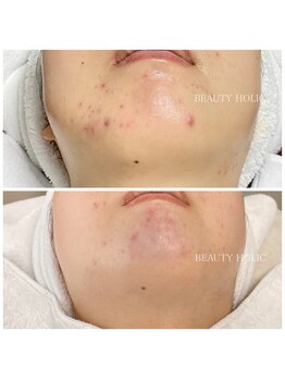 ビューティーホリック 蘇我店(BEAUTY HOLIC)/