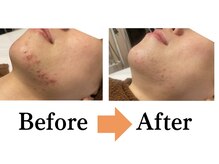 アランルージュ(ALANROUGE)/劇的★ビフォーアフター