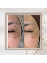 ビープラスサロン(Be plus salon)/