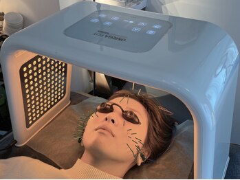 アオヤマ サロン ワイゼット(AOYAMA SALON YZ)の写真/《毛穴・くすみ・赤み・ニキビケアに》肌状態にあわせた4色LED×美容鍼で肌管理ケア◎敏感肌の方も相談OK!