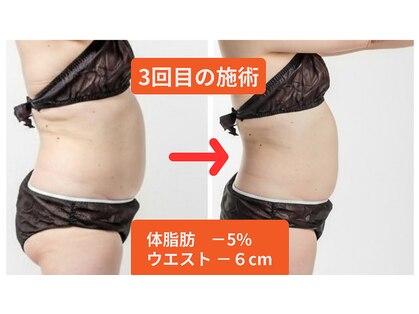 ヨサパーク アカーシャ(YOSA PARK AKASHA)の写真