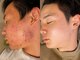コハル(KOHARU)の写真/【男性の症例多数】男性特有のニキビ・毛穴の改善、髭剃りによるカミソリ負け予防に◎清潔感UPのモテ美肌!