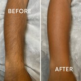 メンズ ザ シュガーリング(MEN'S The Sugaring)