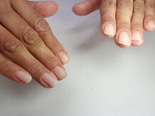 ビジュー ネイル(Bijoux)/クリアジェル ジェルネイル