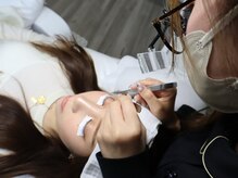 アイスタイル リリーフ(Eye Style Relief)/施術中