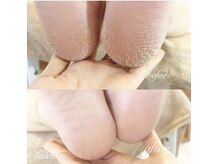 ララヴィー(Lalavie)の雰囲気（ひどい巻爪、たこ、魚の目、角質のお悩みもご相談下さい）