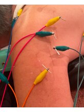 ジェイペック鍼灸整骨院/肩が上がらない、痛みに