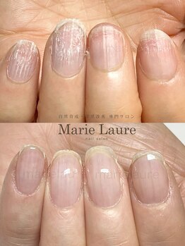 マリーロール 淀屋橋本店(Marie Laure)/自爪育成/深爪矯正/ネイルケア