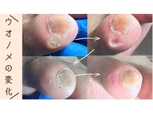 巻き爪補正店 那覇店/