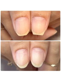 自爪育成・クリア