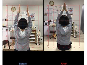 ストレチックス 近江八幡店/BeforeAfter