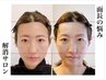 新★【面長矯正】～メスを使用せず骨格を変える美容施術～当サロン考案