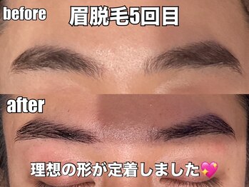 リエル(RIEL)/【眉脱毛】