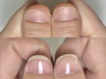 フェミニンネイル(Feminine Nail)