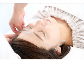 ひのくま鍼灸整骨院の写真/美容鍼でむくみ改善！女性鍼灸師がほうれい線・たるみケアで、自信あふれる表情へ導きます☆