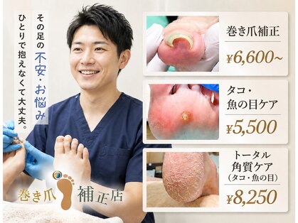 仙台巻き爪補正店の写真