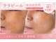 アウラ 砺波店(AULA)の写真