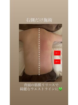 ウララカ(uraraka)/