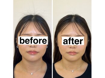 ベルガ 福岡店(Bellega)/