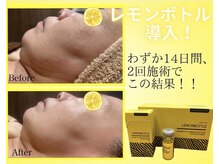 美ネージュ/レモンボトル