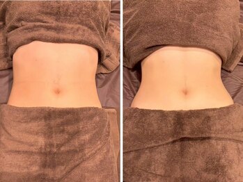 ビュウナ 銀座(BEAUNA)/マルチウェーブリフト