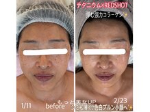 アルページュ(Arpege)/スッキリ革命★キープ力は大！