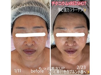 アルページュ(Arpege)/スッキリ革命★キープ力は大！