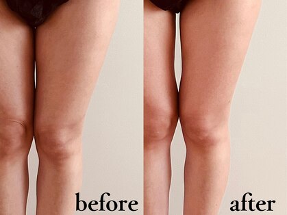 スリラ(SuriLa)の写真