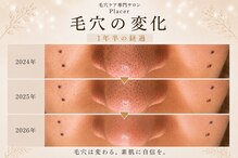 プラセル(Placer)