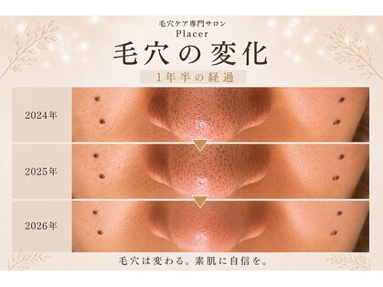 プラセル(Placer)の写真