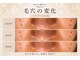 プラセル(Placer)の写真