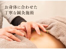 りふぁいん鍼灸整骨院 八王子北野店の雰囲気（鍼灸施術から美容鍼まで幅広く対応◎ ）