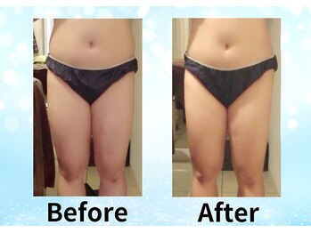 ル プランタン 難波店/Before→After