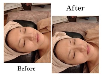 エステティック ライム(Esthetic Lime)/何度も触りたくなるお肌毛穴ケア