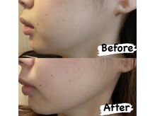 ベル(Belle)/◇ハイパーナイフ