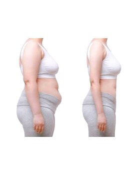 短期集中コースのあるサロン