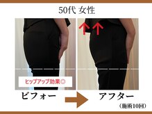 リラモ 布施本店(RELAMO)/【痩身エステ】ビフォーアフター