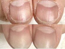 グラシナ 鳥丸店/自爪に見えませんか？