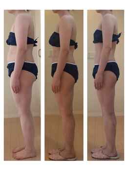 ホロニック ベルサンテ(Holonic Belle Sante)/メディセルハイブリッド