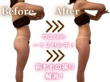 ディオネ/痩身ビフォーアフター【6ヶ月】