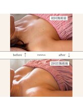 エミニナル(EMININAL)/【バストケア】ビフォーアフター